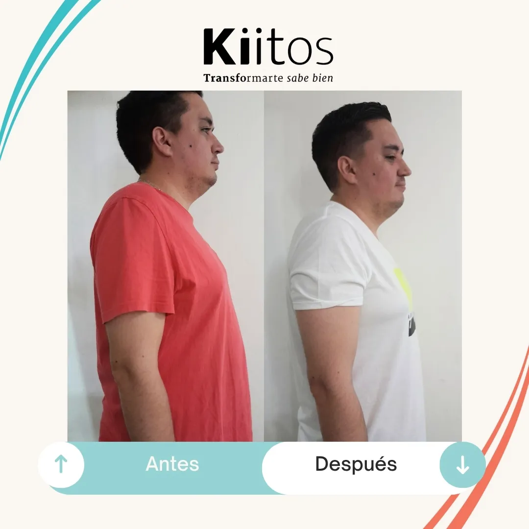 Fotografías de antes y después compartidas por la comunidad Kiitos