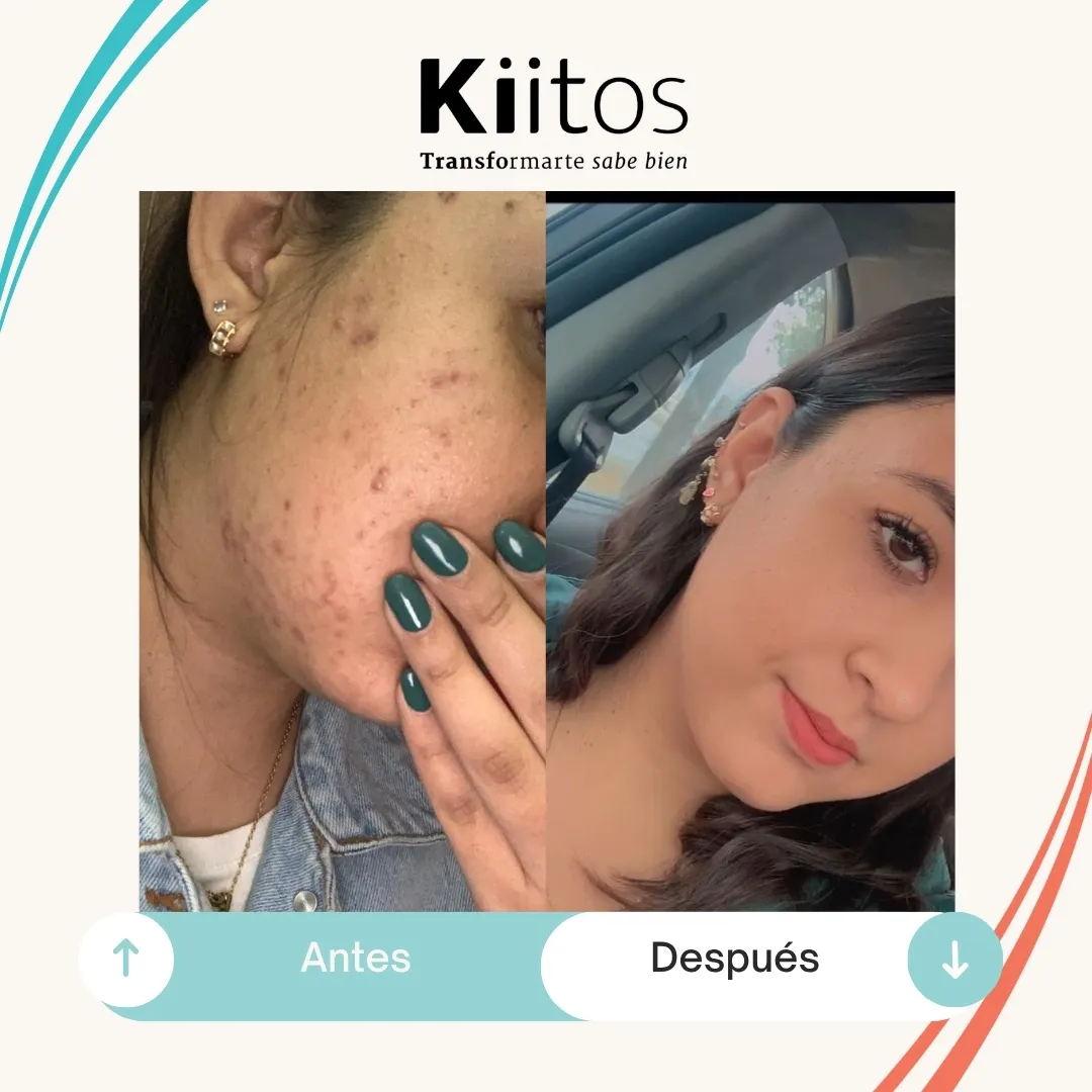 Fotografías de antes y después compartidas por la comunidad Kiitos